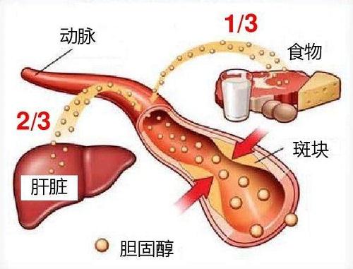 胆固醇高的原因和危害