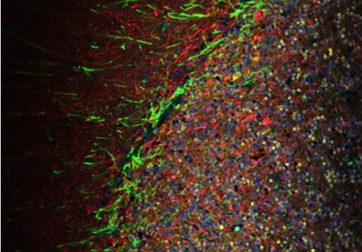 Anti-NeuN antibody- Neuronal Marker (ab177487)