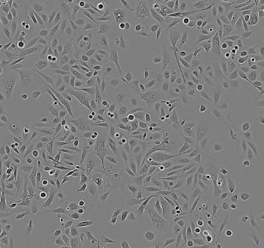 NCI-H520人肺腺鳞癌贴壁细胞系的应用