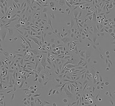 NCI-H520人肺腺鳞癌贴壁细胞系