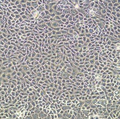 Intrahepatic Bile Duct Epithelial Cells.png