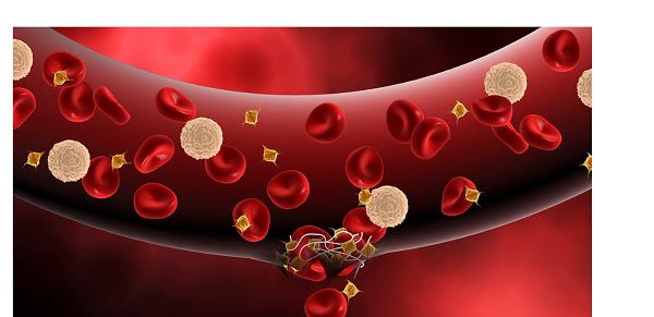 Fig2.Anticoagulation