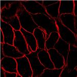 AIE Red Probe for Plasma Membrane pictures