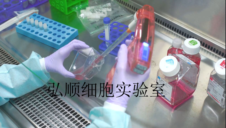 HCC-2279细胞：人肺腺鳞癌细胞