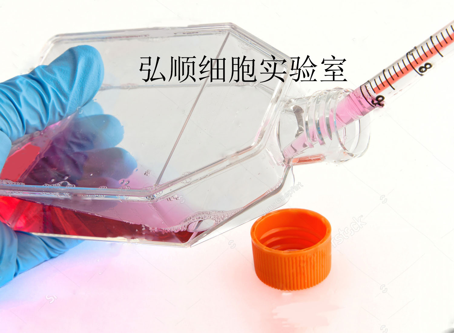 HuNS1细胞：人多发性骨髓瘤细胞