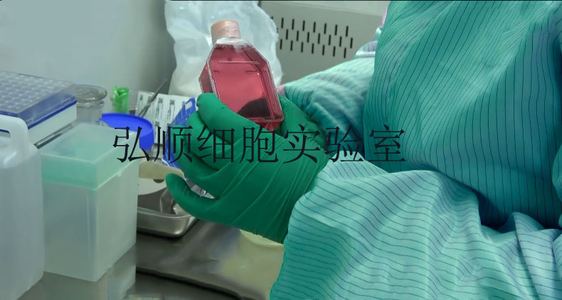 GC9811-P|人胃癌腹膜高转移细胞