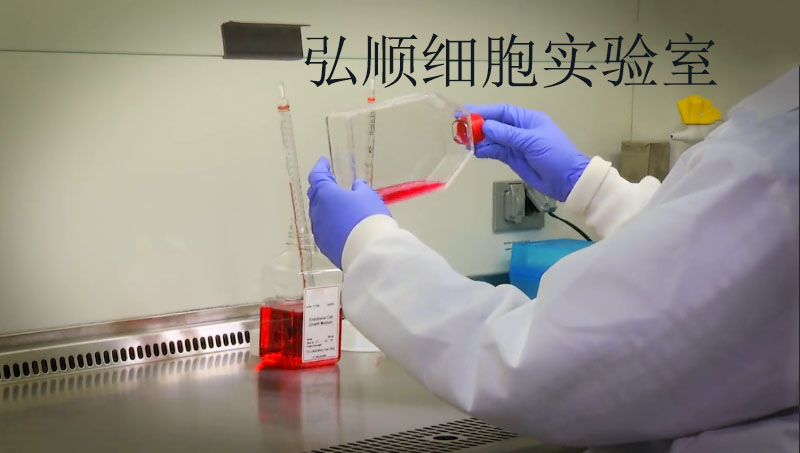 EFM-19 Cell；人乳腺管癌细胞