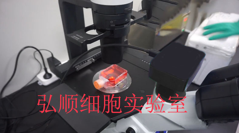 NCI-H2171 Cell<人小细胞肺癌细胞系>