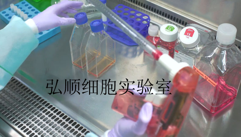 MDST8 Cell<人结肠癌细胞系>