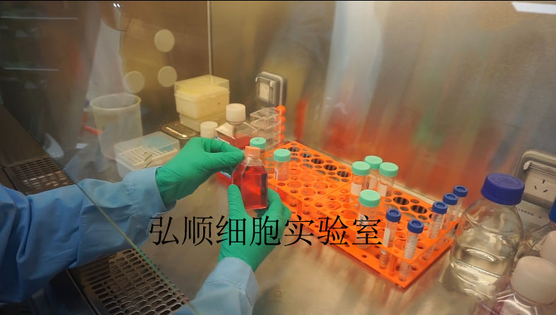 SK-MEL-5 Cell Line|人恶性黑色素瘤细胞