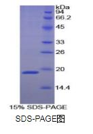 膜联蛋白A1(ANXA1)重组蛋白