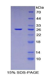 133kDa核孔蛋白(NUP133)重组蛋白