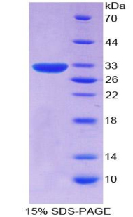 CD109分子(CD109)重组蛋白