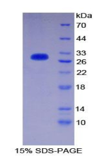 CD1d分子(CD1d)重组蛋白