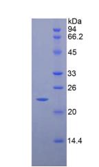 CD8b分子(CD8b)重组蛋白