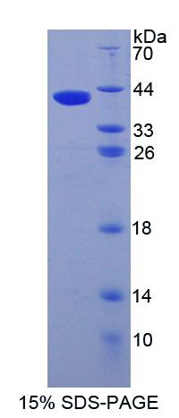 Ig样域蛋白粘附分子1(AMIGO1)重组蛋白