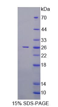 RAS癌基因家族成员RAB1A(RAB1A)重组蛋白