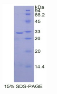 UDP葡糖醛酸基转移酶1家族多肽A1(UGT1A1)重组蛋白