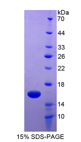 癌胚抗原相关细胞粘附分子6(CEACAM6)重组蛋白