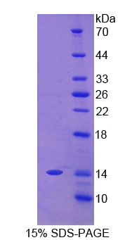 癌胚抗原相关细胞粘附分子7(CEACAM7)重组蛋白