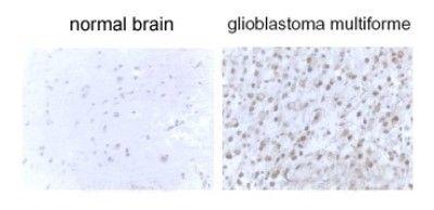 LC3B antibody