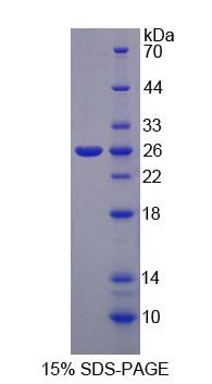 活化T-细胞核因子2(NFATC2)重组蛋白