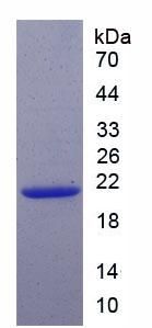 周期素依赖性激酶抑制因子1A(CDKN1A)重组蛋白