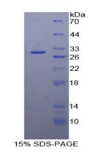 纤溶酶原激活物抑制因子2(PAI2)重组蛋白