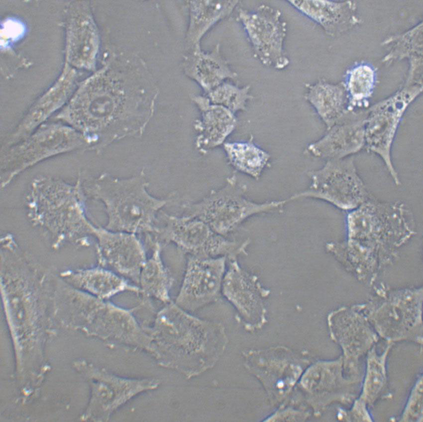 HCCC-9810 Cell:人胆管细胞型肝癌细胞系