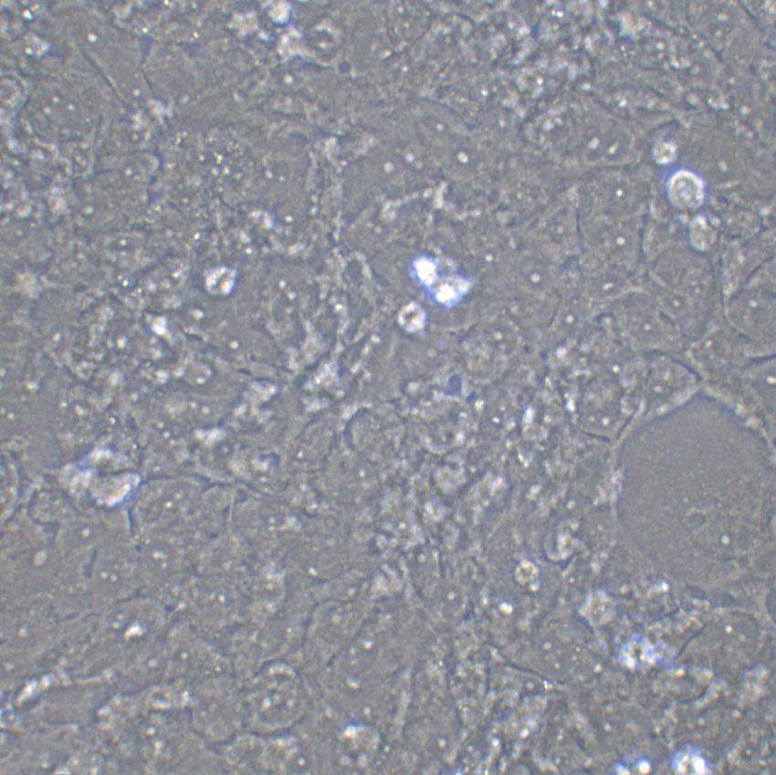 NCI-H441 Cell:人肺腺癌细胞系