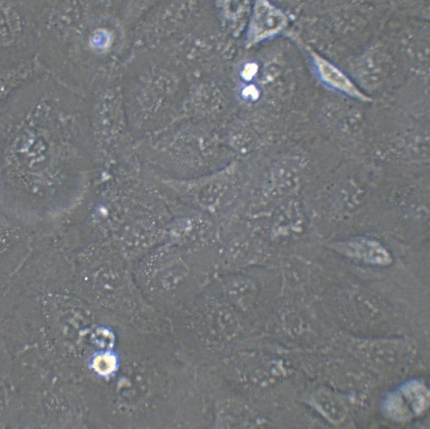 Calu-3 Cell:人肺腺癌细胞系