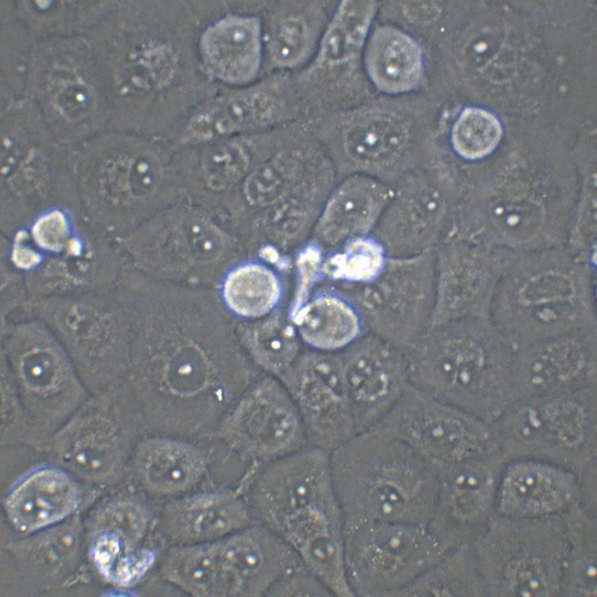 HCCLM3 Cell:高转移人肝癌细胞系