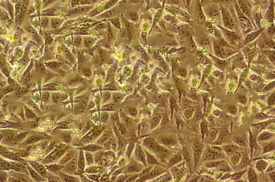 ME-180 Cell:人子宫颈表皮癌细胞系