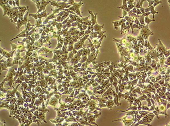 LK2 Cell:人肺鳞癌细胞系