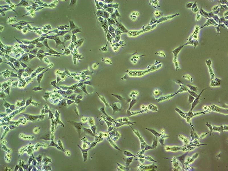 M619 Cell:人侵袭性脉络膜黑色素瘤细胞系