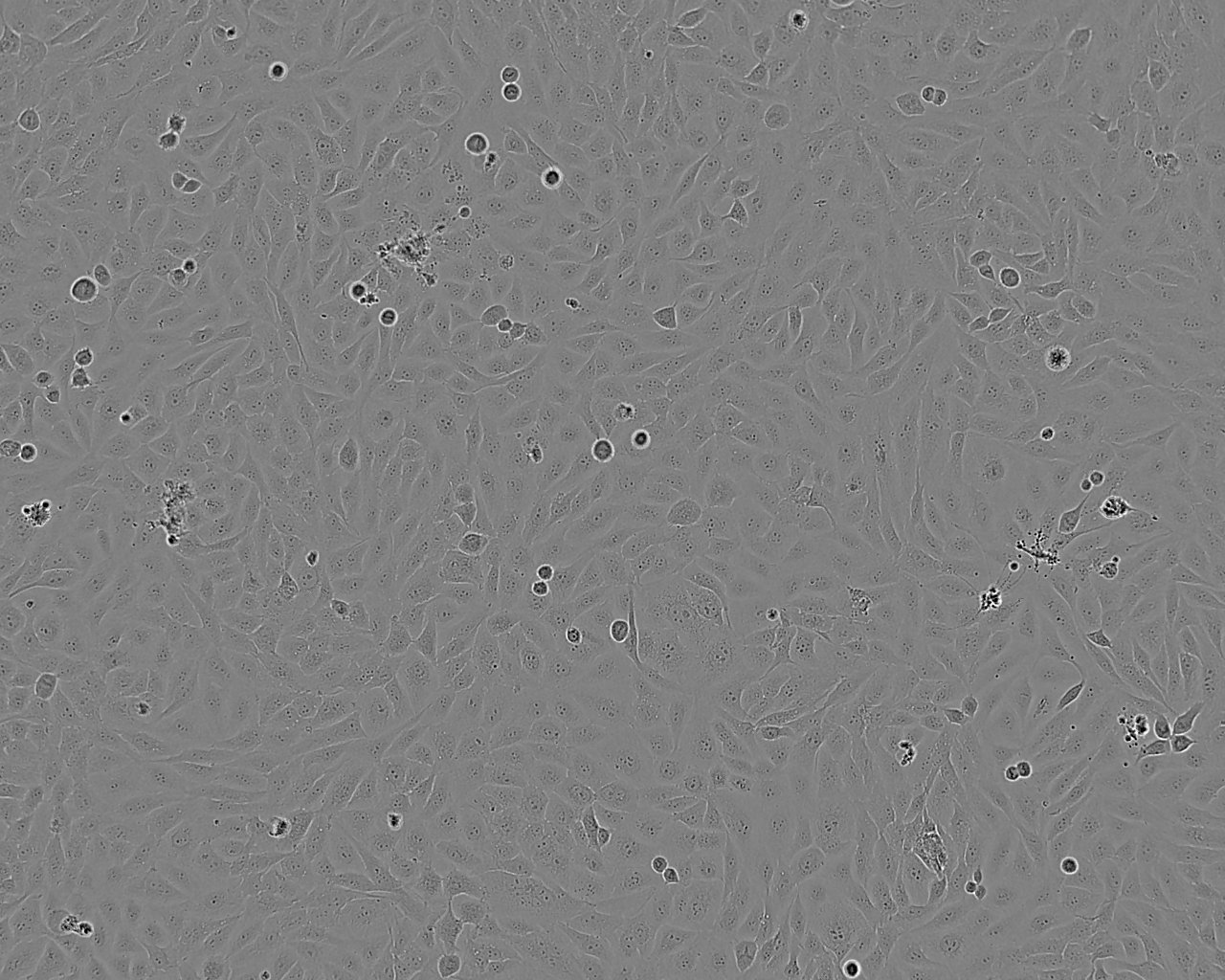 AM-38 Cell:人脑胶质母细胞瘤细胞系