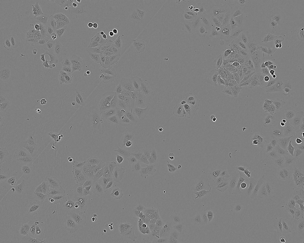 HCC1428 Cell:人乳腺癌细胞系