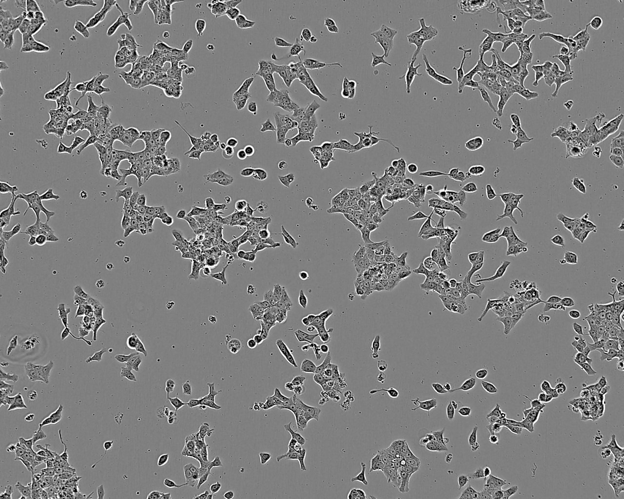 HCC38 Cell:人乳腺导管癌细胞系