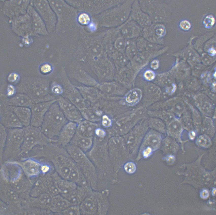 HEY A8 Cell:人卵巢癌细胞系