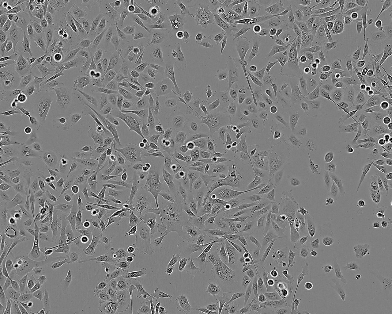 GLC-82 Cell:人肺腺癌细胞系