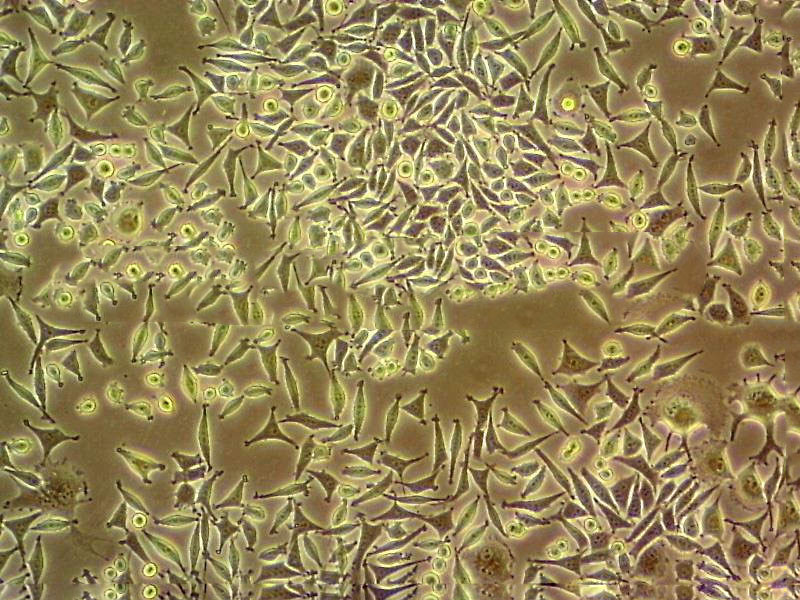 NCI-H1792 Cell:人肺癌腺癌细胞系