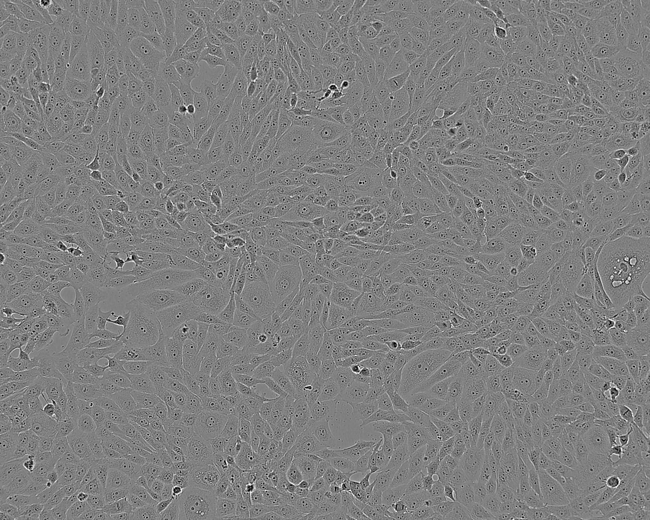 MV4-11 Cell:人急性单核细胞系