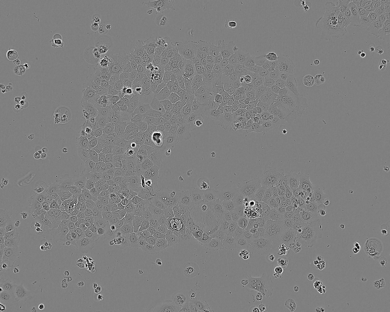 VM-CUB-1 Cell:人膀胱癌细胞系