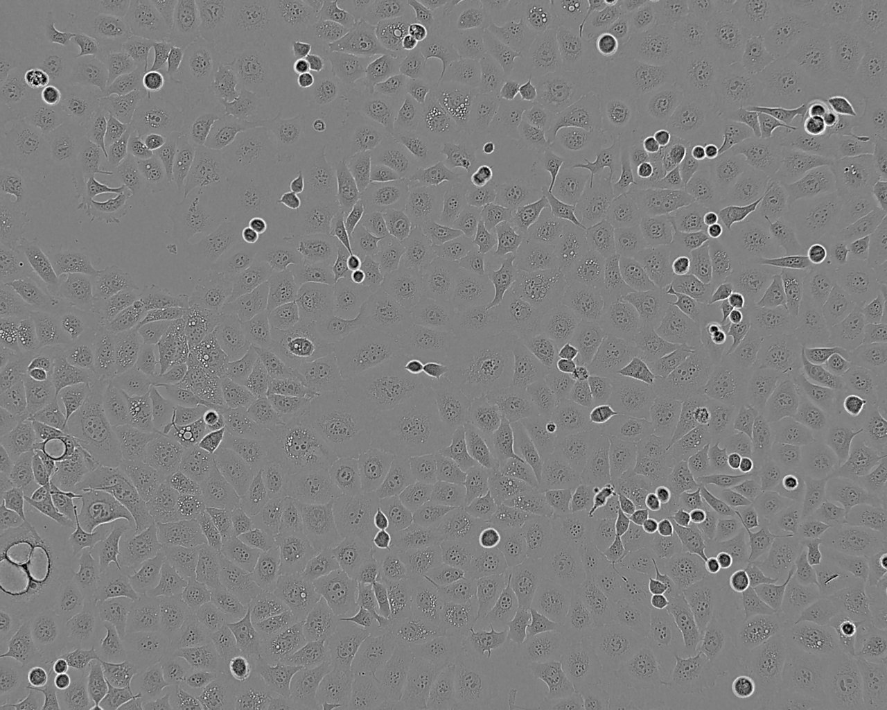 NPA Cell:人甲状腺乳头状癌细胞系