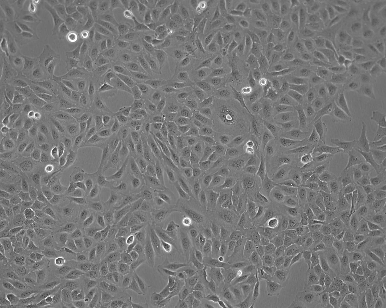 KLM-1 Cell:人胰腺癌细胞系