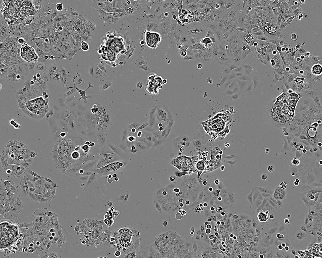 VMRC-LCD Cell:人肺癌腺癌细胞系