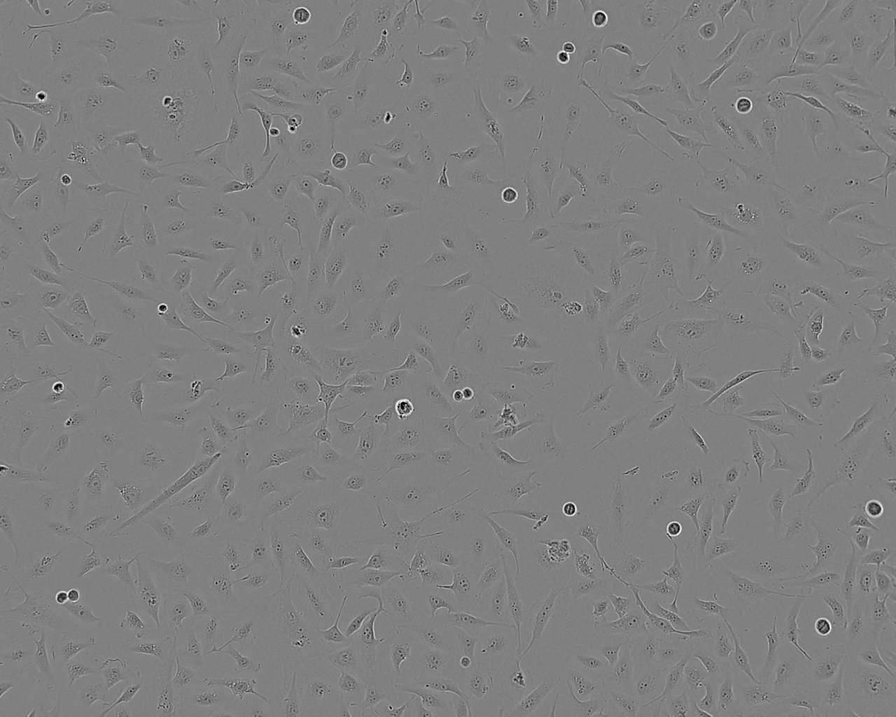 MKN45 Cell:人胃癌细胞系