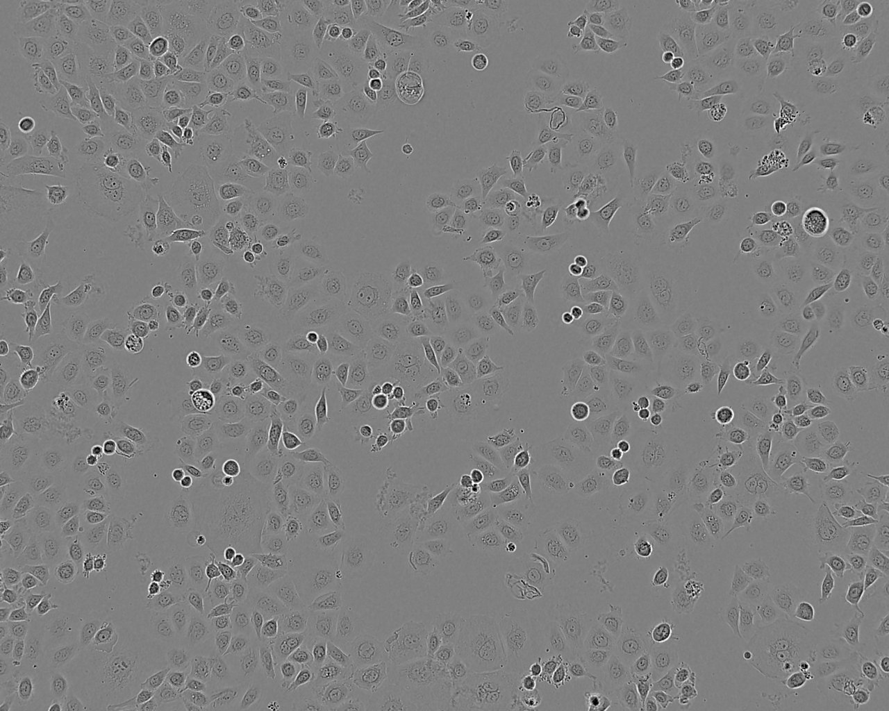 TE-13 Cell:人食管癌细胞系