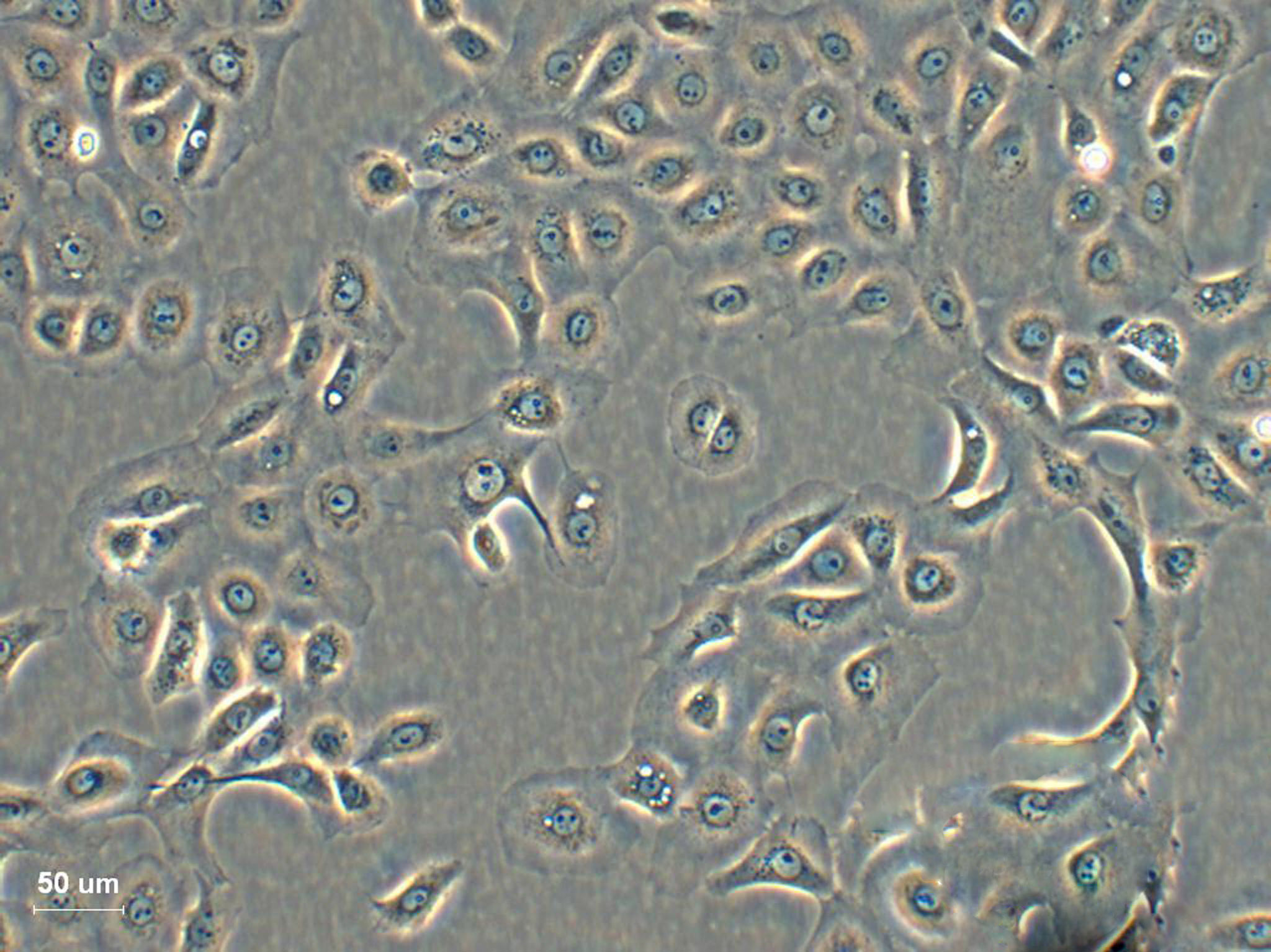 Hca-F Cell:小鼠肝癌细胞系