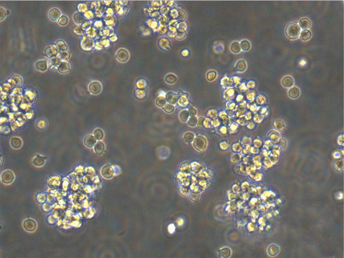 SU-DHL-10 Cell:人B细胞淋巴瘤细胞系